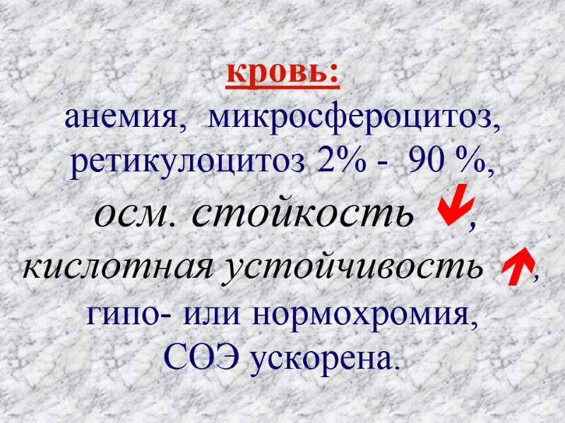 кровь: анемия,  микросфероцитоз, ретикулоцитоз 2% -  90 %,    осм.